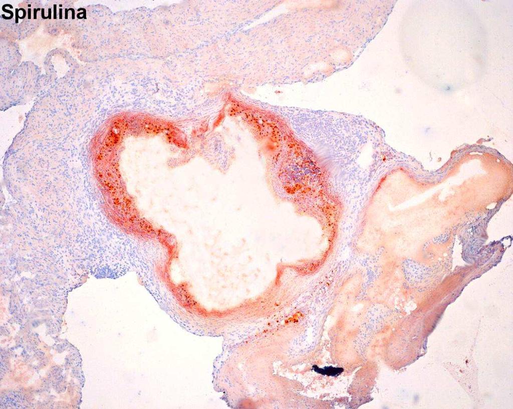 Obrázek 12: Representativní obrázek barvení olejovou červení u skupiny zvířat, kterým byla podávána 8 týdnů cholesterolová dieta společně se Spirulinou platensis Šipky