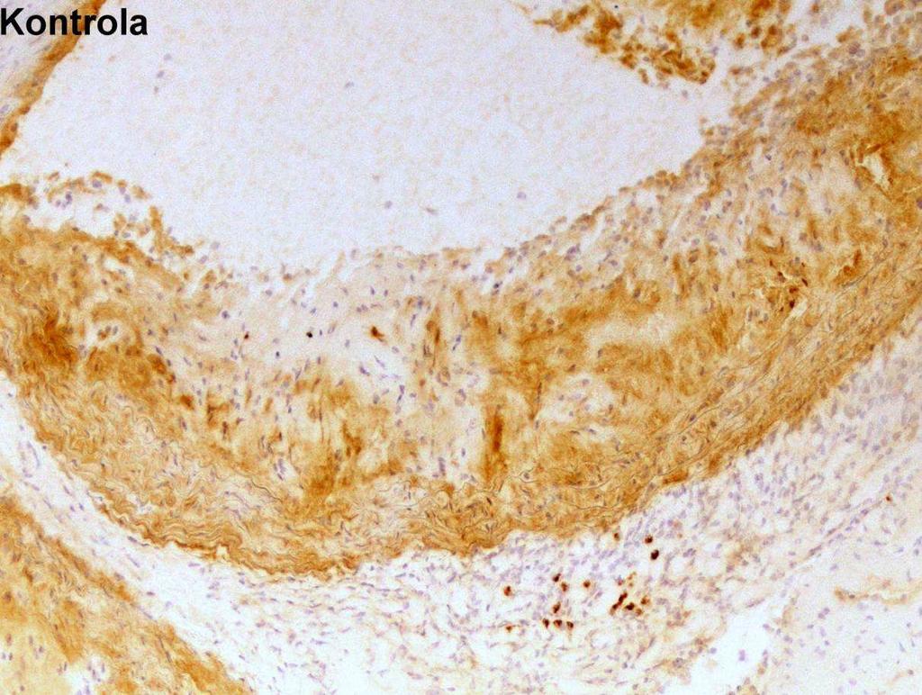 9.3 Imunohistochemická analýza 9.3.1 Imunohistochemické barvení VCAM-1 v oblasti aortálního sinu Exprese VCAM-1 byla pozorována u všech myší v experimentu.