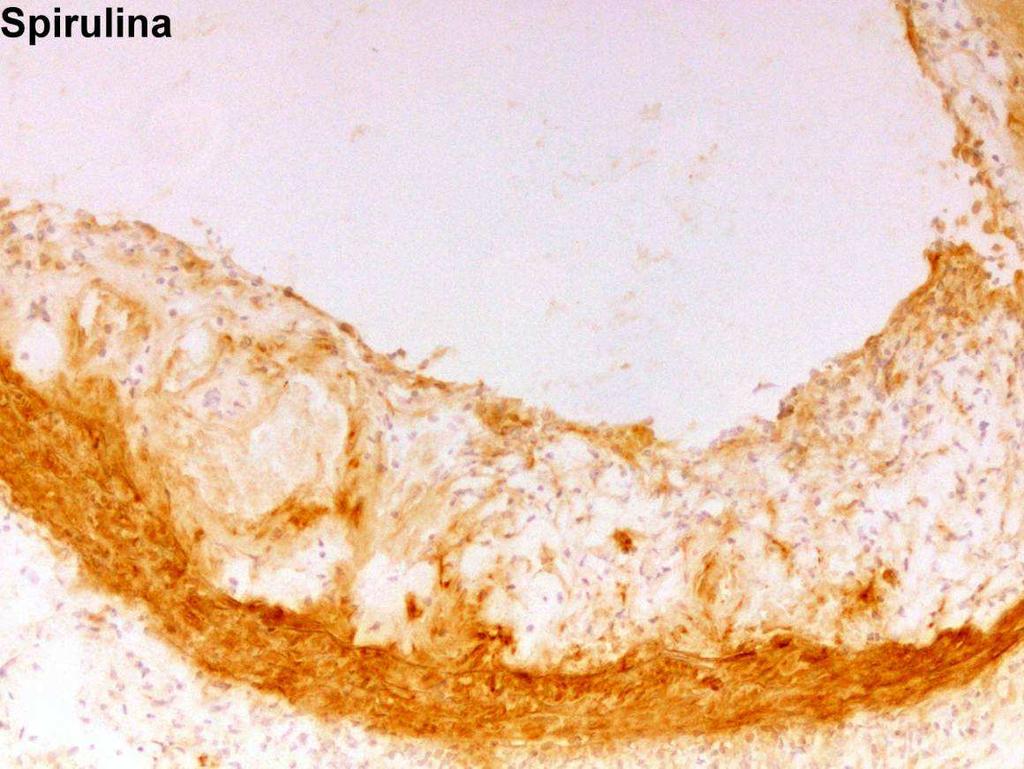 Obrázek 14: Representativní obrázek imunohistochemického barvení VCAM-1 u skupiny zvířat, kterým