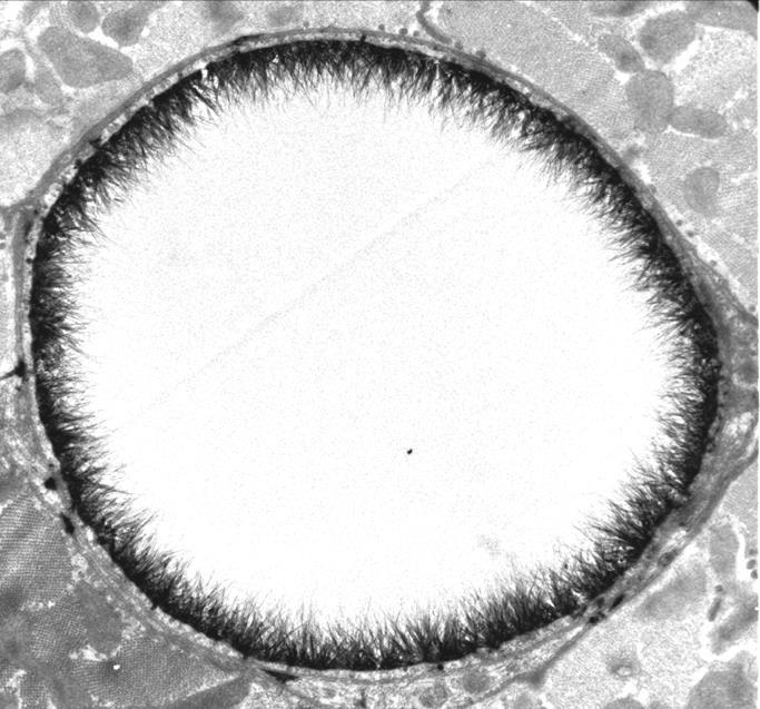 Endothelial glycocalyx protects the vessel wall Glycocalyx 2