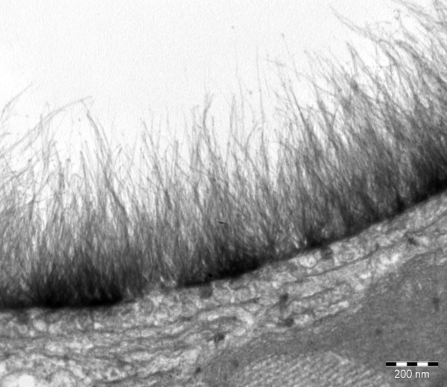 2 µm Electron micrograph of myocardial capillary van den