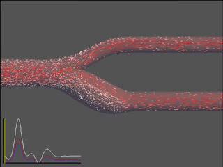 Sites of low or irregular flow in macrovessels are associated