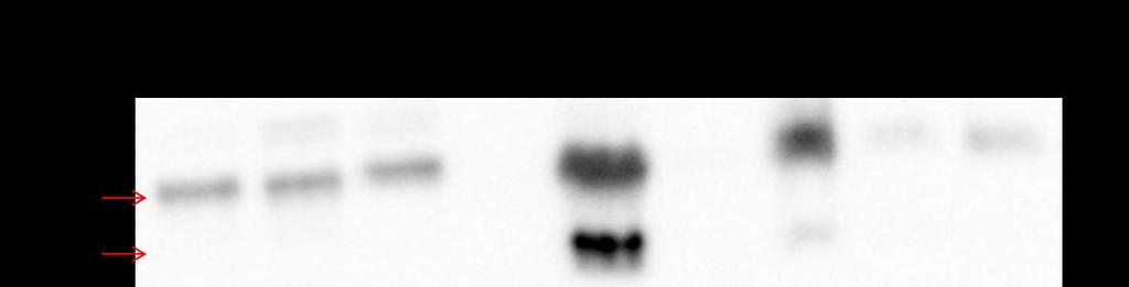 Dle výsledku prezentovaného na obrázku 9. jsme usoudili, že jsme schopni detekovat protein ERK1 ve vzorku z buněčné linie HEK 293.