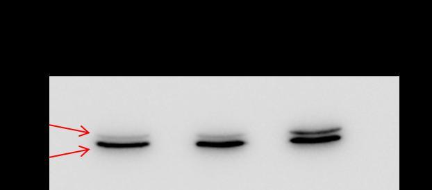 Obrázek 14: Imunodetekce proteinkináz ERK1 za použití protilátky p44/42 MAPK (Erk1/2) (3A7) Mouse mab (viz materiály).