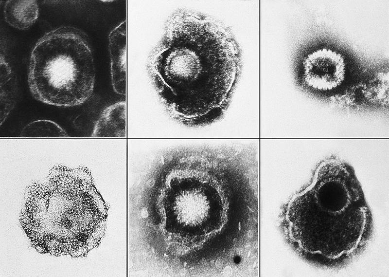 1.2 HERPESVIRY OBECNĚ Herpesviry neboli herpetické viry mají charakteristickou strukturou. Herpesviry jsou poměrně velké viry sférického tvaru.