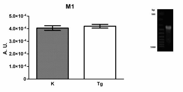 Exprese muskarinových receptorů Graf 3: Porovnání množství mrna genu pro M 1 podtyp muskarinového receptoru u kontrolních (K) a transgenních (Tg) myší. Výsledky jsou uvedeny v poměrných jednotkách (A.