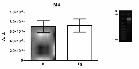 Zobrazen také DNA fragment na agarozovém gelu. Graf 6: Porovnání množství mrna genu pro M 4 podtyp muskarinového receptoru u kontrolních (K) a transgenních (Tg) myší.