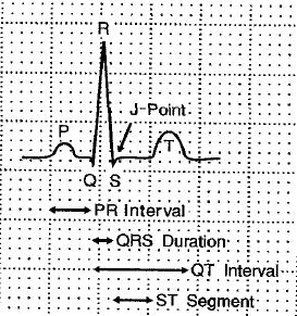 Analýza EKG v časové oblasti Na EKG se hodnotí: srdeční frekvence