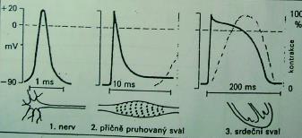 EKG