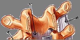 Obecná část Vazivové spoje na páteři Nosné komponenty pohybových segmentů páteře (obratle), jsou fixovány vazy a svaly. Vazivové spoje jsou pasivní částí nosné komponenty hybného segmentu.