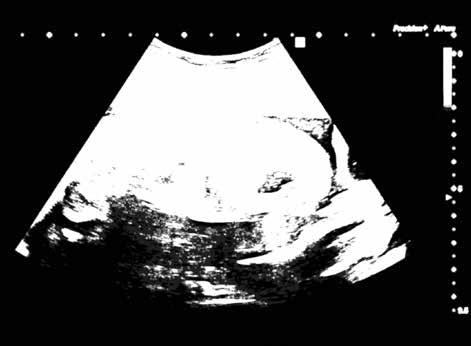Větší klinická jistota Výkonné zobrazovací technologie Aplio poskytují kvalitnější obraz s nižší