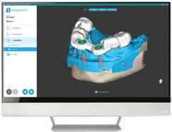 codiagnostix implant plannnig software offers a groundbreaking guided