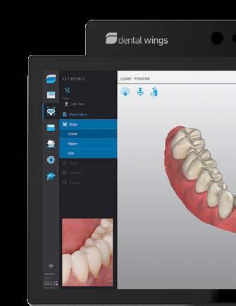 Scan patient with Virtuo Vivo.