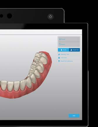 Scan patient with Virtuo Vivo.