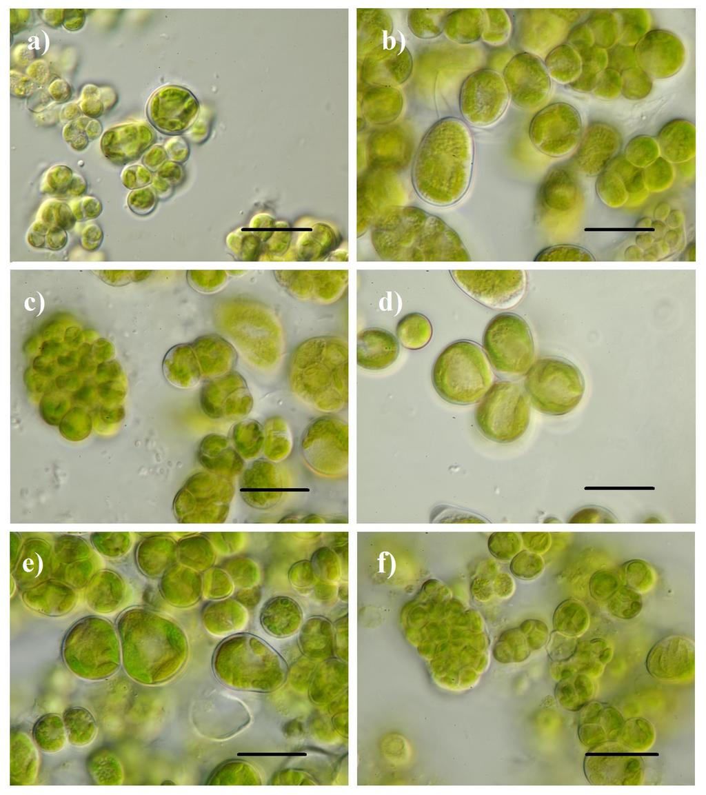 obr. 9: Myrmecia israeliensis je kokální, má kulovité až mírně elipsoidní/ hruškovité buňky veliké 12 24 µm; roste jednotlivě, někdy v tetrádách nebo skupinách.