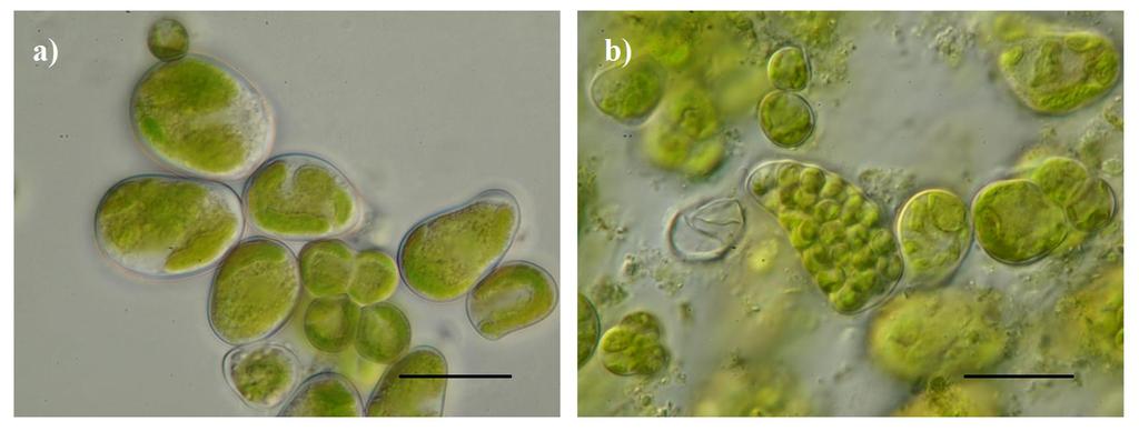 obr. 10: Myrmecia biatorellae. Kokální buňky jsou zamlada kulovité, postupně elipsoidní až hruškovité, 13-30 µm velké. Buněčná stěna někdy tloustne, především v místě hlavního vrcholu (a).