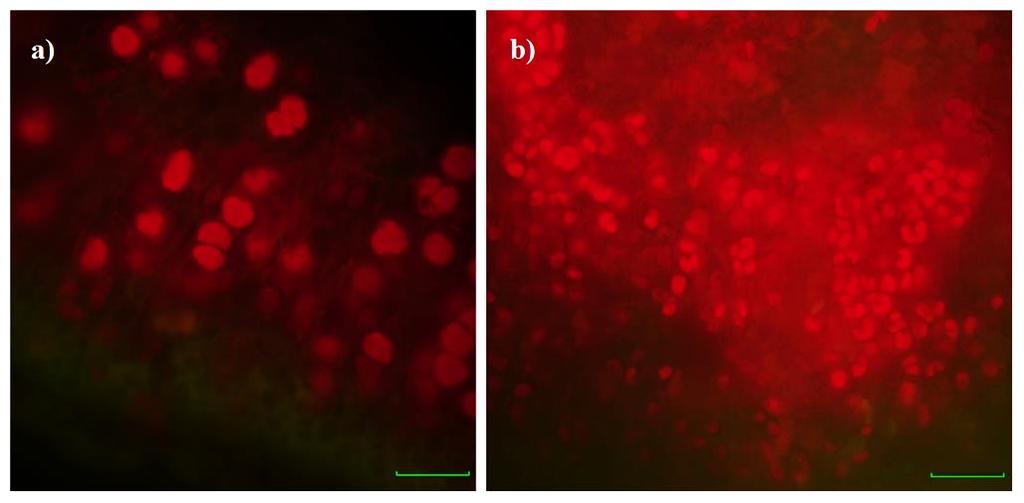 12: Autofluorescence řas ve stélkách lišejníku: a) Myrmecia israeliensis v nitroplodce