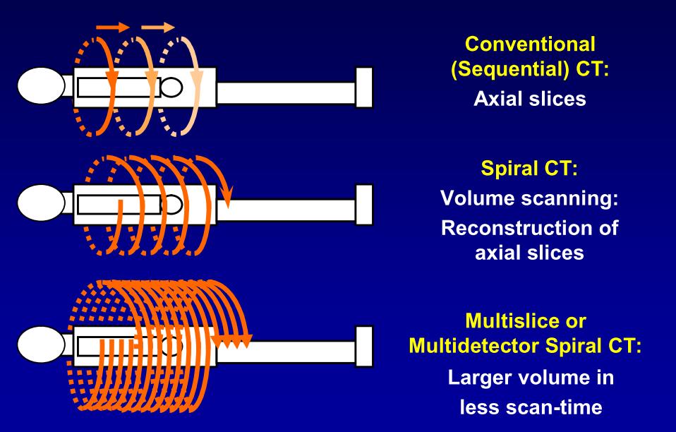 Technika CT zasádní vylepšení CT - kvalitní zobrazení až využitím multidetektorových systémů MDCT nyní