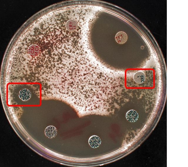 Staphylococcus aureus, fenotyp MRSA, rezistentní cefoxitin a oxacilin Zdroj