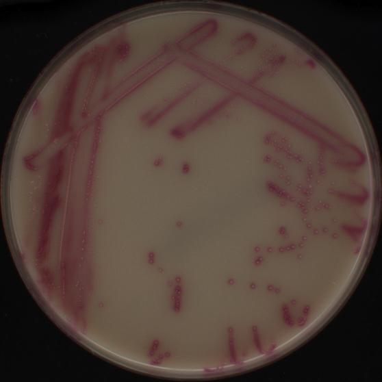 Staphylococcus aureus, fenotyp MRSA na