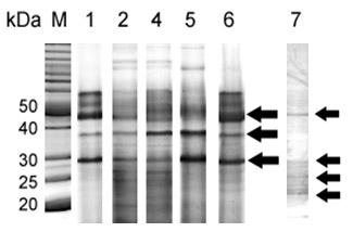 6.2. Biochemická analýza ES produktů F. magna a F. hepatica 6.2.1. Elektroforéza (1-DE) Po 1-DE s ES produkty byly v proteinovém profilu F.