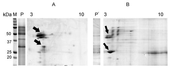 Obr. 12. 2-DE proteinový profil ES produktů F. magna a F. hepatica (12%, 1 mm polyakrylamidový gel barven Coomassie Bio-Safe). Gel A; ES produkty F. magna separované dle pi a molekulové hmotnosti.