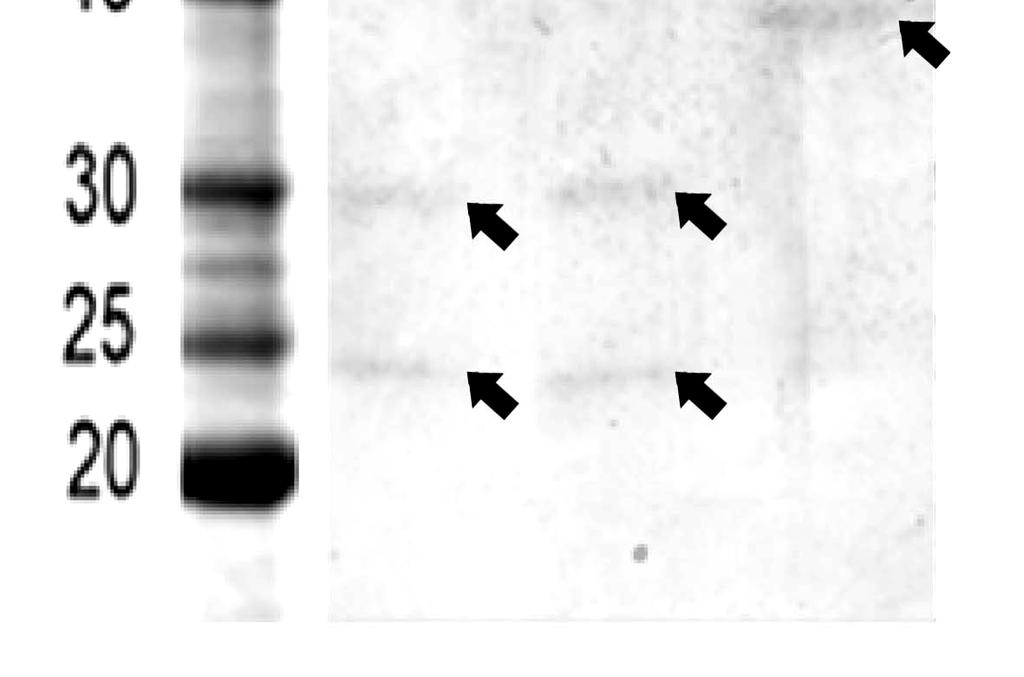 magna pre-purifikováný pomocí anexové samospádové kolonky Macro Prep High Q support (BIO-RAD) byl dále frakcionován s využitím vysokotlaké chromatografické koloně Anex Mono Q do 37 frakcí a separován