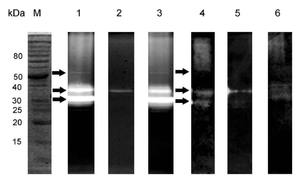 6.2.4. Měření peptidolytické aktivity v ES produktech 6.2.4.1. Zymografie Pro měření aktivity peptidáz obsažených v ES produktech F. magna a F.