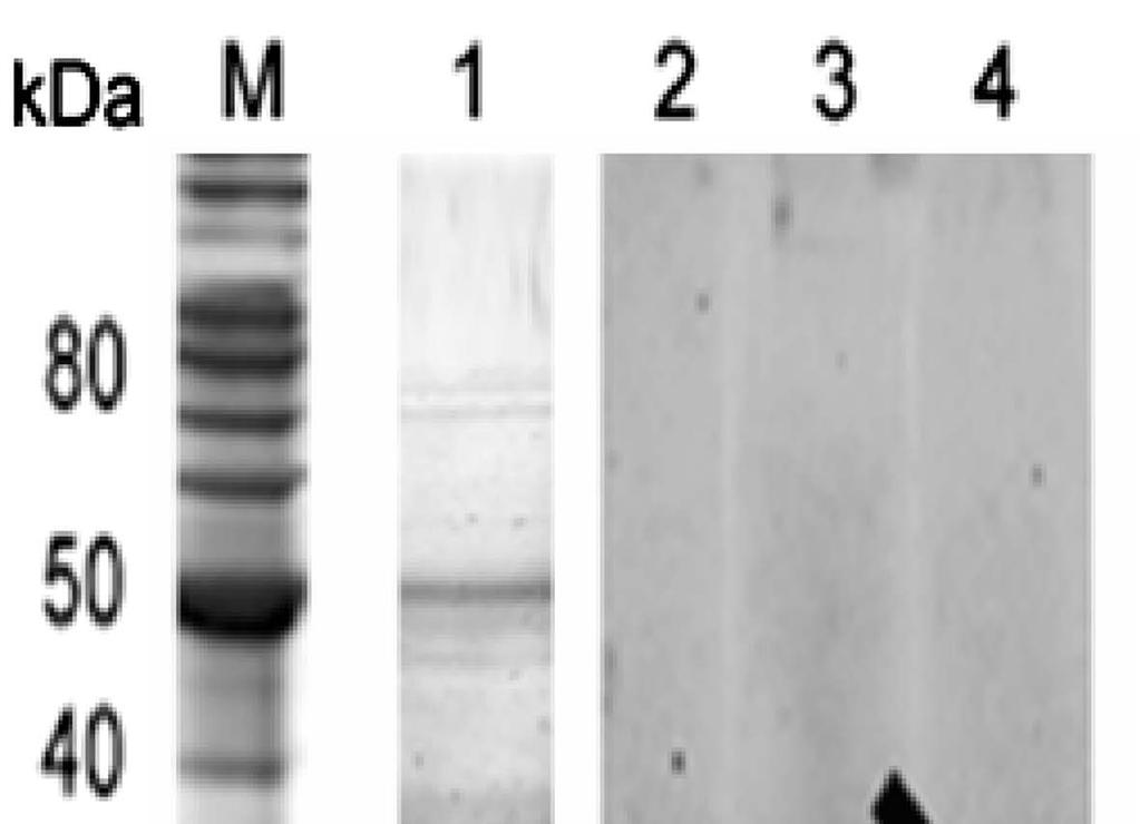 6.2.5. Vazba DCG Detekce cysteinových peptidáz ve vzorcích ES produktů F. magna a F. hepatica byla testována pomocí fluorescenčně značeného DCG (DCG-04 green nebo red) a biotinylovaného DCG-04. 6.2.6. Vazba fluorogeního DCG-04-1-DE Specifická reakce pravděpodobně cysteinových peptidáz z ES proteinů F.