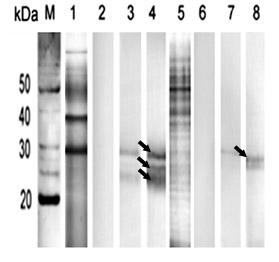 reakce cysteinových peptidáz (pravděpodobně katepsinu L) pomocí E64 byla zaznamenána u obou vzorků ES proteinů podobně jako v případě fluorogeního DCG-04. Obr. 19.