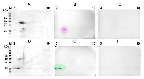 Obr. 20. Detekce vazby biotinylovaného DCG-04 s ES produkty F. magna a F. hepatica transblotovanými na PVDF membránu po 2-DE. A a D; proteinový profil ES produktů F. magna a F. hepatica po 2-DE (12%, 1 mm, polyakrylamidový gel barven Coomassie Bio- Safe).