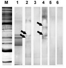 Obr. 25. Imunoblot s rfmcl po 1-DE s jelením/kozím sérem z parazitovaných zvířat. 1; proteinový profil rfmcl (12% 1mm polyakrylamidový gel barven Coomassie Bio-Safe).