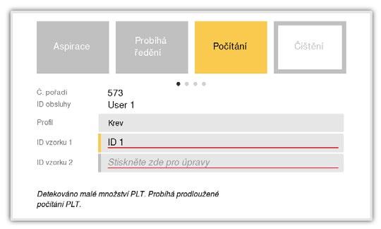 3. Postup (Analýza vzorku) Výsledky Prodloužená doba počítání PLT Jestliže je aktivní Prodloužená doba počítání PLT (viz kap.