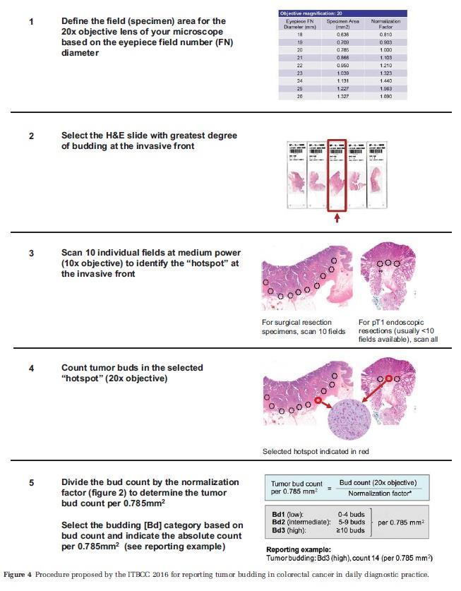 Tumor budding: Bud = klastr 1-4 buněk v linii invaze Manifestace EMT Nezávislý prognostický faktor Asociace s LVI a TNM Indikátor resekce, adjuvantní