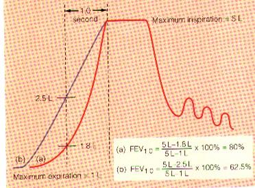 Jednosekundová (jednovteřinová) vitální kapacita plic = po maximálním nádechu ( ) maximální výdech ( ) FEV 1 = za první sekundu FEV 2 = za