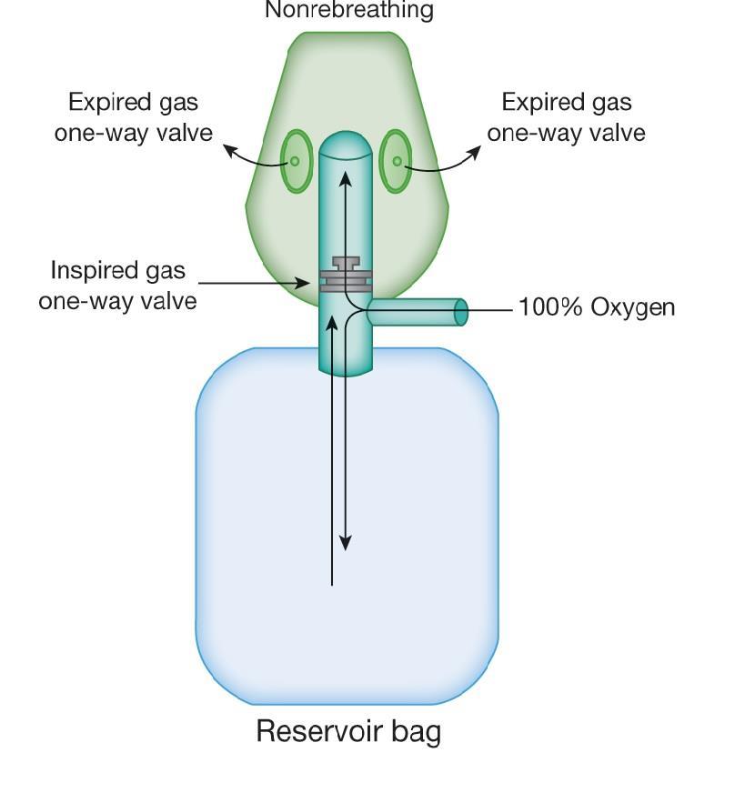 Bez zpětného vdechování jednocestný ventil zabraňuje míšení vydechované a čerstvé směsi chlopně zajišťují vdechování pouze čerstvé