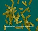bakteriálních kmenů Vývoj obvazů s imobilizovanými