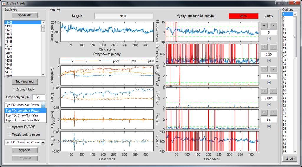Před zobrazením pohybových regresorů a dalších metrik si uživatel může vybrat typ výpočtu FD a nastavit limit počtu skenů [%], ve kterých se vyskytuje excesivní pohyb.
