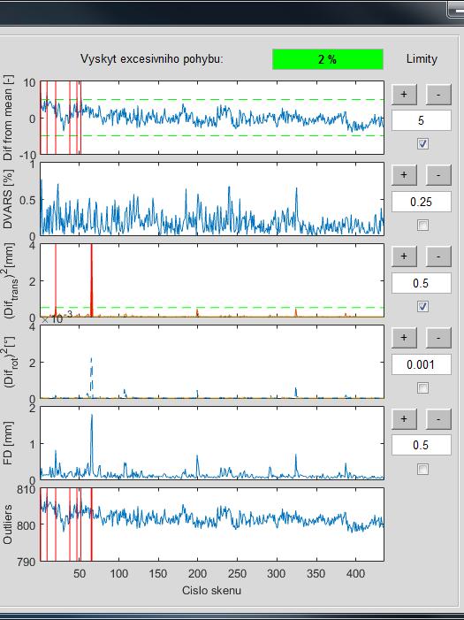Obrázek 34: Zvýšení limitu FD spojené s úbytkem špatných skenů (vlevo) a deaktivace metrik Indexy skenů, u nichž byl vyhodnocen excesivní