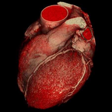 Srdce 2: Cévy, nervy, převodní systém Perikard a topografie Věnčité tepny Srdeční žíly Lymfatika Sympatikus