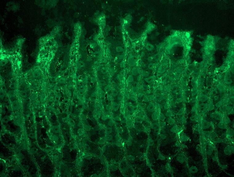 Obrázek 19 protilátky proti cytokeratinu, originální mikrofoto IIF