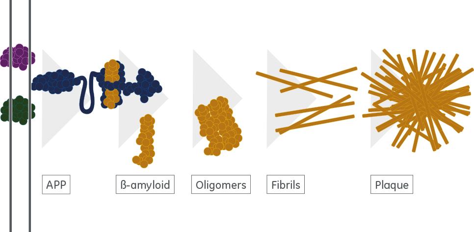 Zobrazuje amyloidové plaky