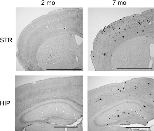 34 E. Machová et al. / Neurobiology of Disease 38 (2010) 27 35 Table 5 Concentration of buffer soluble amyloid β 1-40 and amyloid β 1-42 in cerebral cortex.