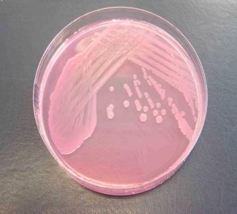 SHIGELLA SP. S.dysenteriae, S.flexneri, S.boydii, S.