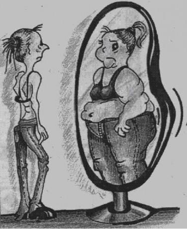 Aktivní udržování abnormálně nízké hmotnosti pod 15 % normy U dětí chybějící přírůstek hmotnosti Strach z tloušťky i při nízké tělesné hmotnosti Výrazné odmítání potravy a úzkostlivé sledování váhy