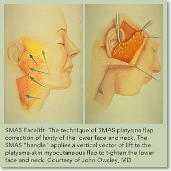 systém (SMAS) souvislá