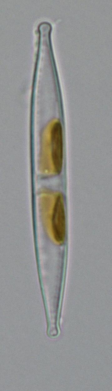 srovnání 3 Nitzschia sp.