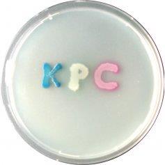 Enterobakterie s produkcí karbapenemáz - CPE A- KPC,