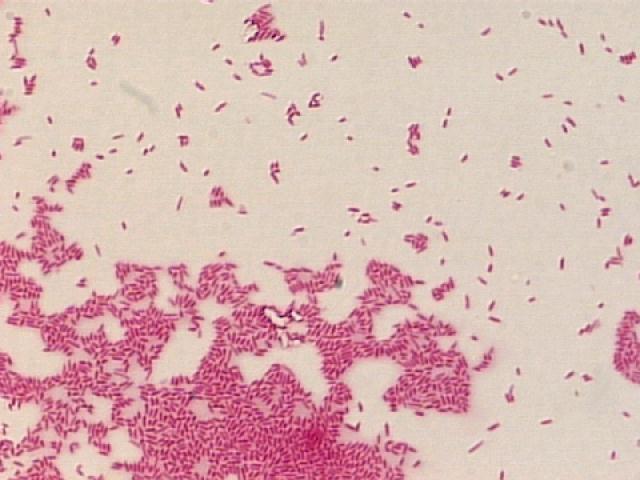 EPIGLOTITIDA etiologické agens: Haemophilus