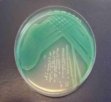 aeruginosa, S. aureus léky I. volby: amoxicilin, cefalosporiny I. gen. léky II. volby: kombinované aminopeniciliny, cefalosporiny II.